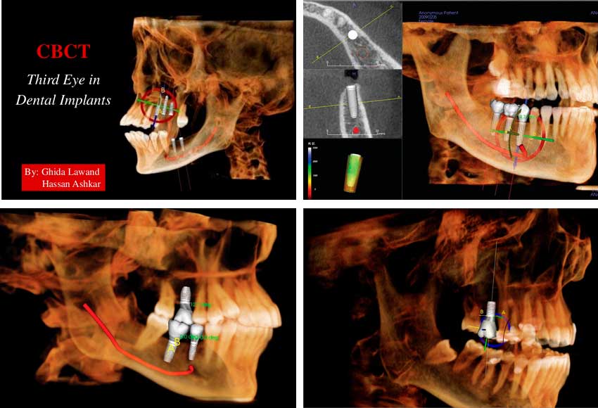 3D Dental Imaging